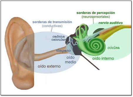 Definición de hipoacusia - Qué es, Significado y Concepto