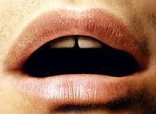 Oral Oral