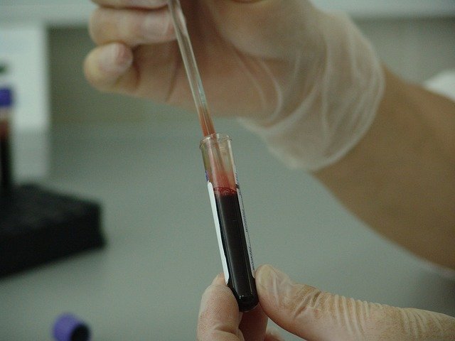 Neutrófilo análisis sangre