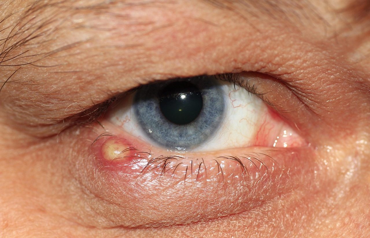 Ojo