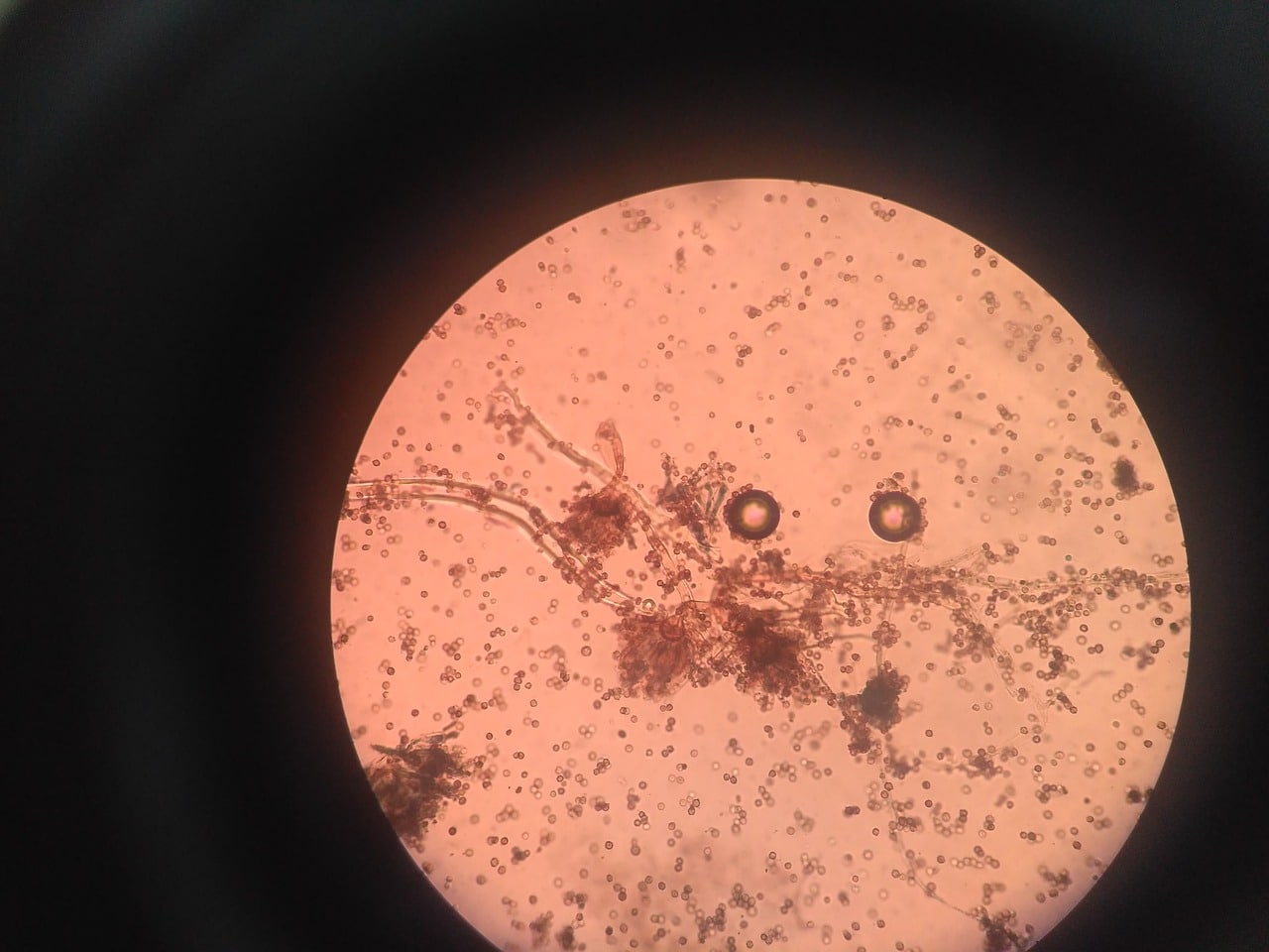 Vista microscópica de parásitos