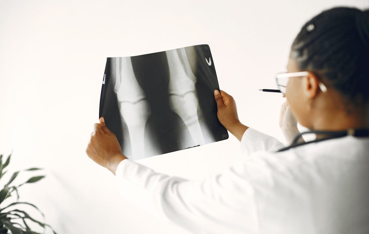 Doctora estudiando una radiografía